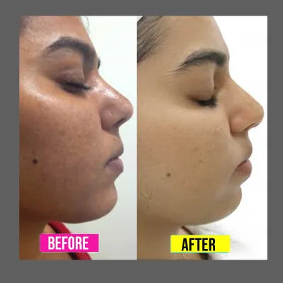 UG® Face Skin Whitening Cream